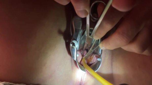 Tenaculum Grasping Cervix For Catheter 7 Min - hclips.com on gratiscinema.com